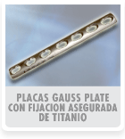 Placas con Fijacion Asegurada