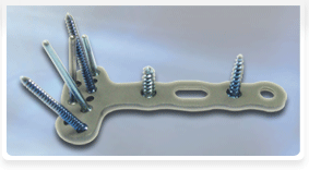 Placas Gauss Plate